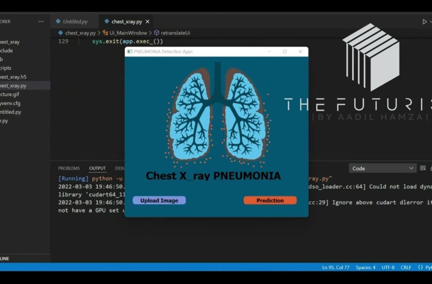  Pneumonia Detection Using Deep Learning in Python | Artificial Intelligence | Aadil Hamza | AI |